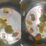 Doon Medical College: जीरा समझकर छात्रों ने खाया खाना, मेस की सब्जी में निकले कीड़े;पता चलने पर जमकर हंगामा